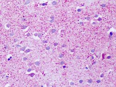 Immunohistochemistry-Paraffin: GPR139 Antibody - BSA Free [NLS2716]