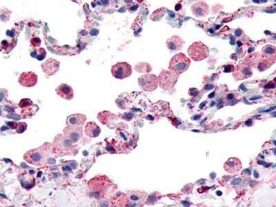 Immunohistochemistry-Paraffin: GPR139 Antibody - BSA Free [NLS2717]