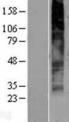 Western Blot: GPR141 Overexpression Lysate [NBP2-04443]