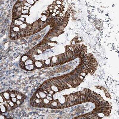 Immunohistochemistry-Paraffin: GPR142 Antibody [NBP1-87286]