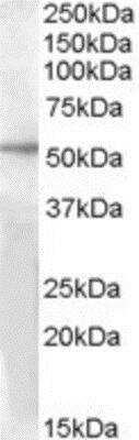 Western Blot: GPR142 Antibody [NBP1-20929]