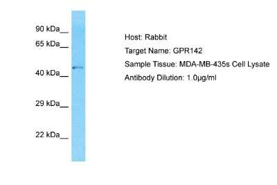 Western Blot: GPR142 Antibody [NBP2-85004]