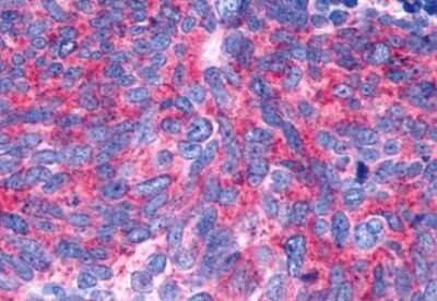 Immunohistochemistry-Paraffin: GPR146 Antibody - BSA Free [NBP1-02659]