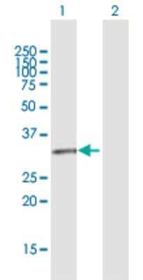 Western Blot: GPR146 Antibody [H00115330-D01P]