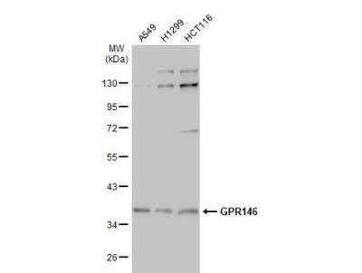 Western Blot: GPR146 Antibody [NBP2-16718]