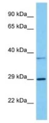 Western Blot: GPR146 Antibody [NBP3-10154]