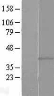 Western Blot: GPR146 Overexpression Lysate [NBL1-11254]