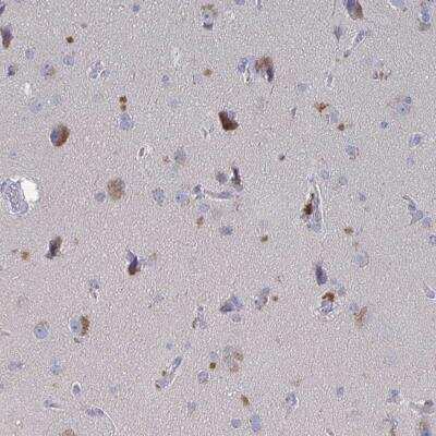 Immunohistochemistry-Paraffin: GPR148 Antibody [NBP2-32550]