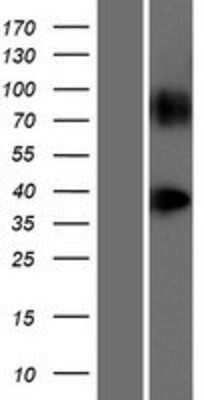 Western Blot: GPR148 Overexpression Lysate [NBL1-11255]