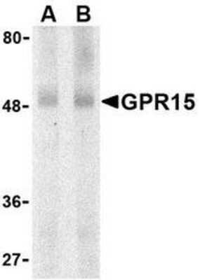 Western Blot: GPR15 AntibodyBSA Free [NBP1-76466]