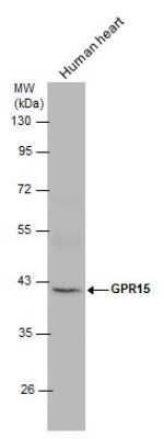 Western Blot: GPR15 Antibody [NBP3-13000]