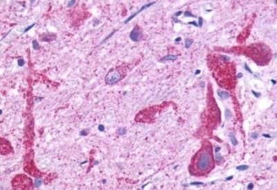 Immunohistochemistry-Paraffin: GPR150 Antibody [NBP3-14349]