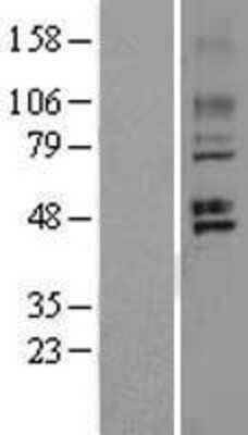 Western Blot: GPR150 Overexpression Lysate [NBL1-11256]