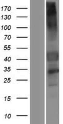 Western Blot: GPR151 Overexpression Lysate [NBP2-04766]