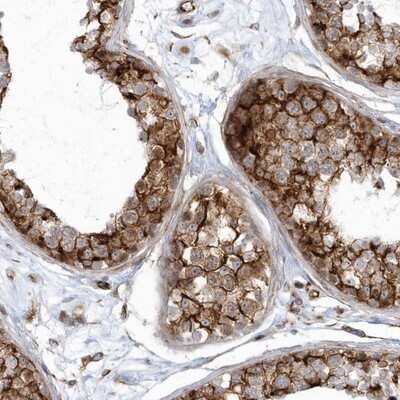 Immunohistochemistry-Paraffin: GPR152 Antibody [NBP1-87284]