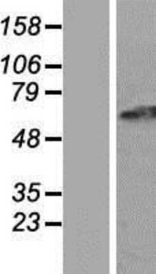 Western Blot: GPR152 Overexpression Lysate [NBP2-04514]