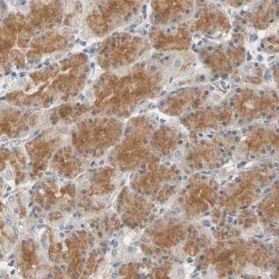 Immunohistochemistry: GPR153 Antibody [NBP1-87288]