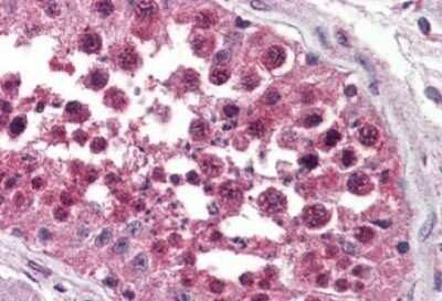 Immunohistochemistry-Paraffin: GPR154 Antibody - BSA Free [NBP1-44315]