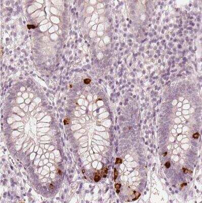 Immunohistochemistry-Paraffin: GPR154 Antibody [NBP1-91966]