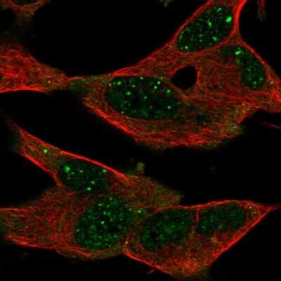 Immunocytochemistry/ Immunofluorescence: GPR155 Antibody [NBP2-56118]