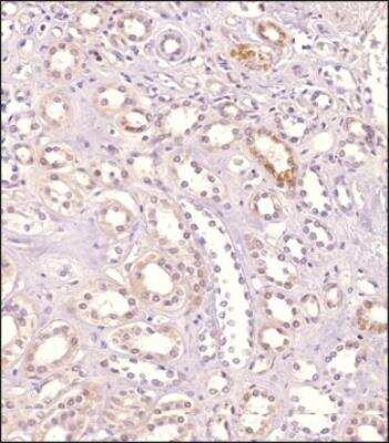 Immunohistochemistry-Paraffin: GPR155 Antibody - BSA Free [NBP1-50626]