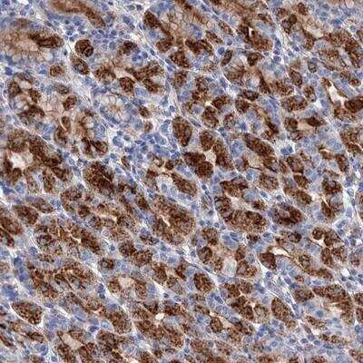 Immunohistochemistry-Paraffin: GPR155 Antibody [NBP1-85254]