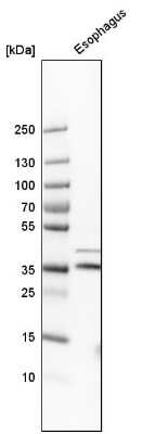 Western Blot: GPR157 Antibody [NBP1-83724]