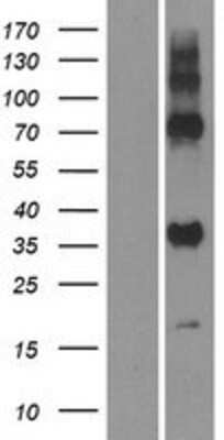 Western Blot: GPR157 Overexpression Lysate [NBP2-06250]