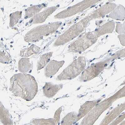 Immunohistochemistry-Paraffin: GPR158 Antibody [NBP1-81437]