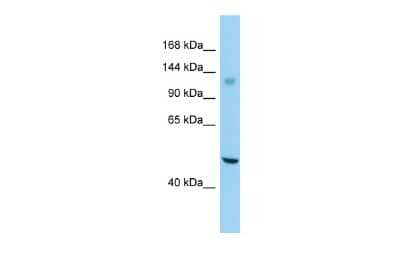 Western Blot: GPR158 Antibody [NBP2-82932]