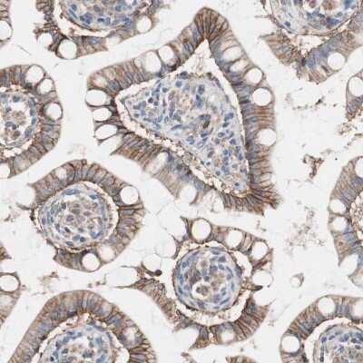 Immunohistochemistry-Paraffin: GPR160 Antibody [NBP1-83345]