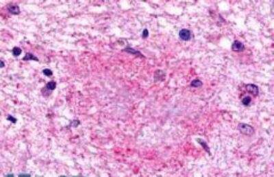 Immunohistochemistry-Paraffin: GPR160 Antibody - BSA Free [NLS542]