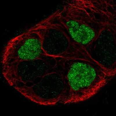 Immunocytochemistry/ Immunofluorescence: GPR161 Antibody [NBP2-58006]