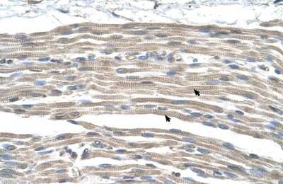 Immunohistochemistry-Paraffin: GPR161 Antibody [NBP1-60122]