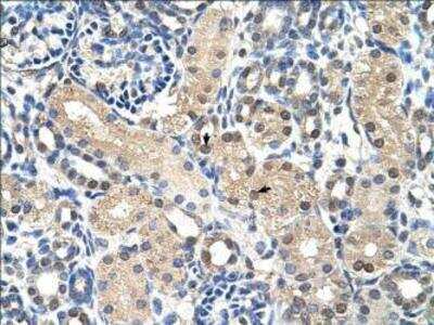 Immunohistochemistry-Paraffin: GPR161 Antibody [NBP1-69244]