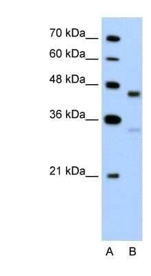 Western Blot: GPR161 Antibody [NBP1-60114]