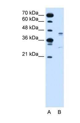 Western Blot: GPR161 Antibody [NBP1-60122]