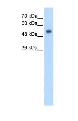 Western Blot: GPR161 Antibody [NBP1-69244]