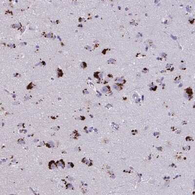 Immunohistochemistry-Paraffin: GPR162 Antibody [NBP2-33740]