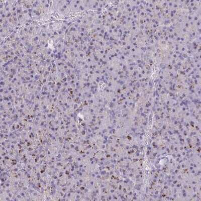 Immunohistochemistry-Paraffin: GPR162 Antibody [NBP2-33740]