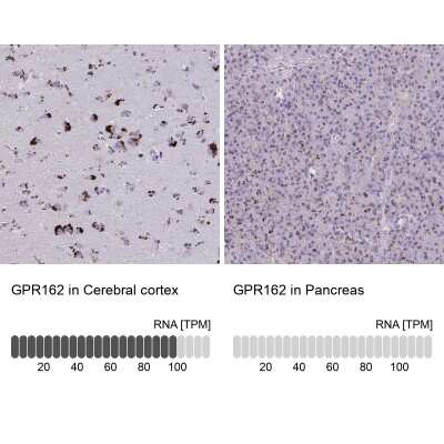 Immunohistochemistry-Paraffin: GPR162 Antibody [NBP2-33740]