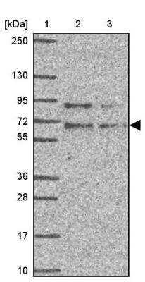 Western Blot: GPR162 Antibody [NBP2-33740]