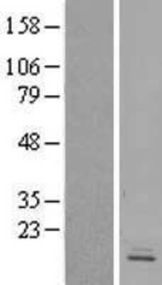 Western Blot: GPR162 Overexpression Lysate [NBP2-07335]