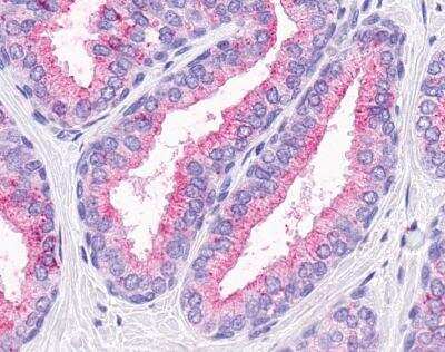 Immunohistochemistry-Paraffin: GPR164 Antibody - BSA Free [NLS1854]