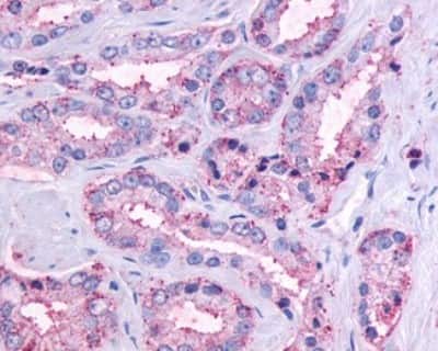 Immunohistochemistry-Paraffin: GPR164 Antibody - BSA Free [NLS1854]