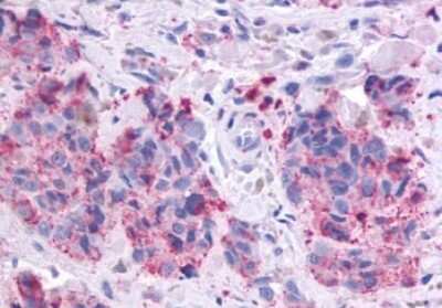 Immunohistochemistry-Paraffin: GPR164 Antibody - BSA Free [NLS1854]