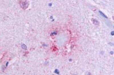Immunohistochemistry-Paraffin: GPR164 Antibody - BSA Free [NLS1854]
