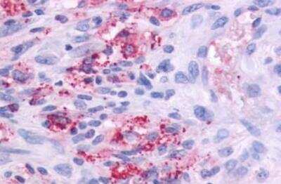 Immunohistochemistry-Paraffin: GPR164 Antibody - BSA Free [NLS1854]
