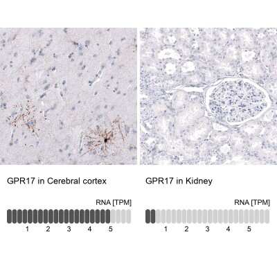 Immunohistochemistry-Paraffin: GPR17 Antibody (CL10474) [NBP3-07993]