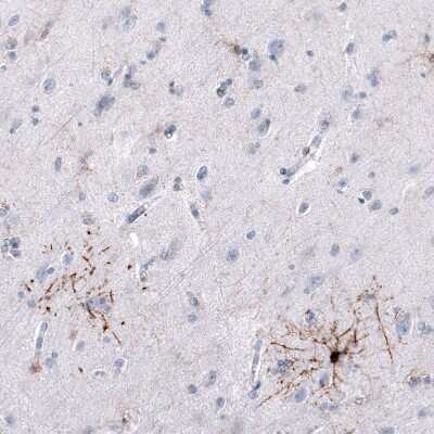 Immunohistochemistry-Paraffin: GPR17 Antibody (CL10474) [NBP3-07993]